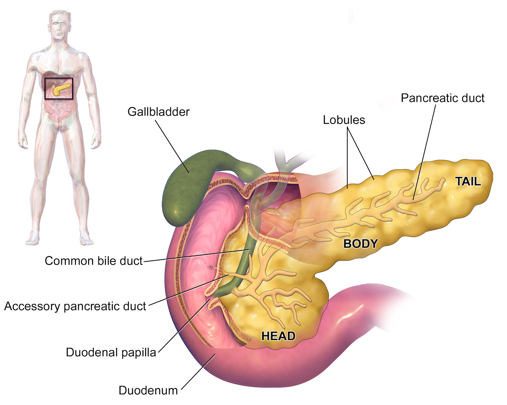 Pancreatic pseudocyst